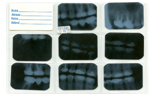 Dental X-Rays