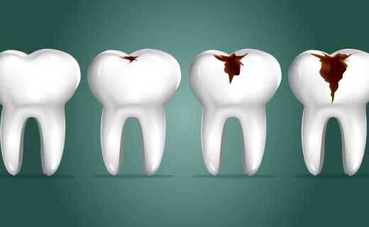 dca-blog_eating-disorders-and-dental-health